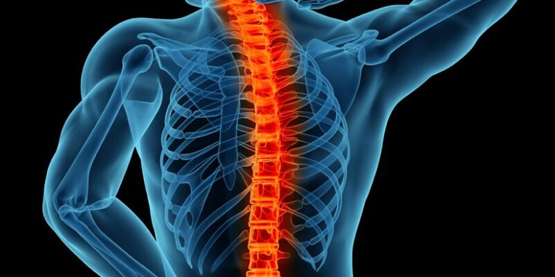 Is Spinal Fusion only treatment for Back Pain?